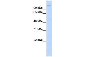 TXNDC16 antibody used at 1 ug/ml to detect target protein. (TXNDC16 antibody  (N-Term))