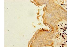 Immunohistochemistry of paraffin-embedded human skin tissue using ABIN7160694 at dilution of 1:100 (B3GNT2 antibody  (AA 29-397))