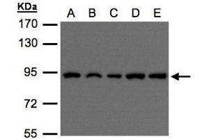 WB Image Sample(30 μg of whole cell lysate) A:H1299 B:HeLa S3 , C:Hep G2 , D:MOLT4 , E:Raji , 7. (VPS35 antibody  (C-Term))