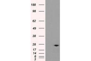 Western Blotting (WB) image for anti-Dicarbonyl/L-Xylulose Reductase (DCXR) antibody (ABIN1497787) (DCXR antibody)