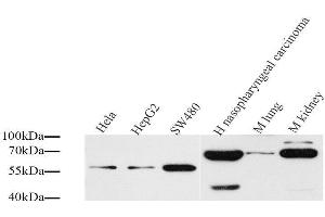 Western Blot analysis of various samples using CD54 Polyclonal Antibody at dilution of 1:1000. (ICAM1 antibody)