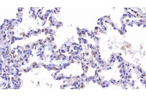 CFTR antibody