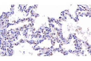 Detection of CFTR in Human Lung Tissue using Polyclonal Antibody to Cystic Fibrosis Transmembrane Conductance Regulator (CFTR) (CFTR antibody)