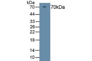 Detection of Recombinant HDAC1, Mouse using Polyclonal Antibody to Histone Deacetylase 1 (HDAC1) (HDAC1 antibody  (AA 1-482))