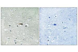 Immunohistochemistry (IHC) image for anti-Mps1 (TTK) (Thr676) antibody (ABIN1848269) (Mps1 antibody  (Thr676))