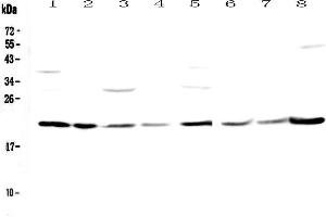 Western blot analysis of GLO1 using anti-GLO1 antibody . (GLO1 antibody  (AA 2-184))