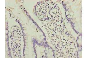 Immunohistochemistry of paraffin-embedded human small intestine tissue using ABIN7162226 at dilution of 1:100 (PLAC1L antibody  (AA 74-158))