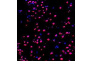 Immunofluorescence of paraffin embedded mouse brain using NAIF1 (ABIN7074867) at dilution of 1:650 (400x lens) (NAIF1 antibody)