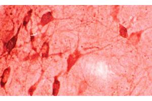 Immunohistochemistry analysis using Rabbit Anti-HO-1 Polyclonal Antibody . (HMOX1 antibody  (Atto 594))