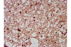 IHC image of ABIN7161362 diluted at 1:200 and staining in paraffin-embedded human brain tissue performed on a Leica BondTM system. (NrCAM antibody  (AA 1194-1299))