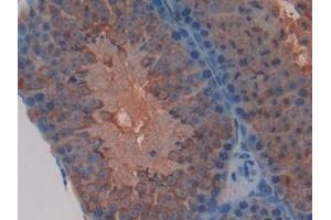 Detection of TFAM in Mouse Testis Tissue using Polyclonal Antibody to Transcription Factor A, Mitochondrial (TFAM) (TFAM antibody  (AA 43-243))