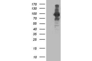 HEK293T cells were transfected with the pCMV6-ENTRY control (Left lane) or pCMV6-ENTRY ANAPC2 (Right lane) cDNA for 48 hrs and lysed. (ANAPC2 antibody)