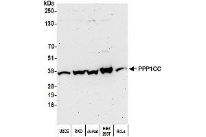 Western Blotting (WB) image for anti-Protein Phosphatase 1, Catalytic Subunit, gamma Isoform (PPP1CC) (C-Term) antibody (ABIN7454685)