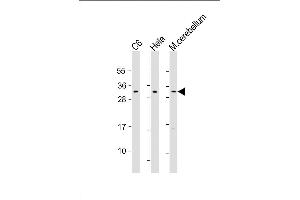Lane 1: C6, Lane 2: HeLa, Lane 3: mouse cerebellum lysate at 20 µg per lane, probed with bsm-51197M PIp1 (538CT16. (PAK1IP1 antibody)
