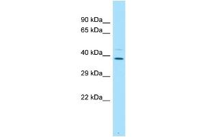 WB Suggested Anti-PLSCR4 Antibody Titration: 1. (PLSCR4 antibody  (C-Term))