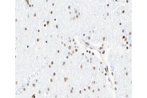 ABIN6267065 at 1/100 staining human Brain tissue sections by IHC-P. (Histone 3 antibody  (H3K18ac))