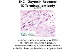 Image no. 1 for anti-Oxytocin Receptor (OXTR) (C-Term), (Cytoplasmic Domain) antibody (ABIN1737738)