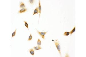 IHC analysis of ASPH using anti-ASPH antibody (ABIN3043790). (Aspartate beta Hydroxylase antibody  (C-Term))