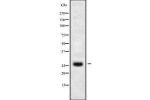 Western blot analysis of CLDN14 using HuvEc whole cell lysates (CLDN14 antibody  (C-Term))