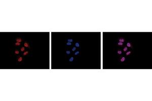 Immunofluorescence Microscopy of anti-Pol II antibody Immunofluorescence Microscopy results of Mouse anti-Pol II antibody. (POLR2A/RPB1 antibody)