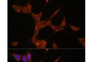 Immunofluorescence analysis of NIH/3T3 cells using AKR1C3 Polyclonal Antibody at dilution of 1:100. (AKR1C3 antibody)