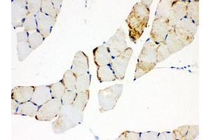 Anti- CPT1B Picoband antibody, IHC(P) IHC(P): Mouse Skeletal Muscle Tissue (CPT1B antibody  (N-Term))