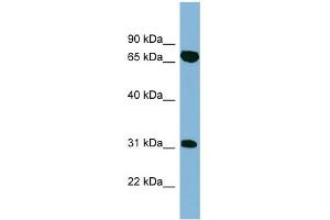WB Suggested Anti-HIRIP3 Antibody Titration: 0. (HIRIP3 antibody  (Middle Region))