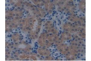 Detection of PDCD6IP in Mouse Kidney Tissue using Polyclonal Antibody to Programmed Cell Death Protein 6 Interacting Protein (PDCD6IP) (ALIX antibody  (AA 1-239))