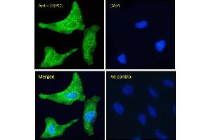 ABIN6391351 Immunofluorescence analysis of paraformaldehyde fixed HeLa cells, permeabilized with 0. (TRPC1 antibody  (Internal Region))