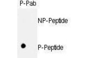 Dot Blot (DB) image for anti-Retinoblastoma 1 (RB1) (pSer811) antibody (ABIN3001786) (Retinoblastoma 1 antibody  (pSer811))