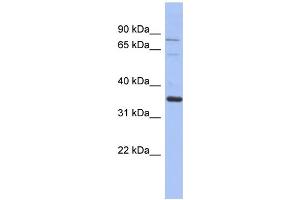 WB Suggested Anti-NRBP2 Antibody Titration: 0. (NRBP2 antibody  (Middle Region))