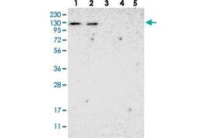 Western blot analysis of Lane 1: RT-4, Lane 2: U-251 MG, Lane 3: Human Plasma, Lane 4: Liver, Lane 5: Tonsil with ADNP2 polyclonal antibody  at 1:250-1:500 dilution. (ADNP2 antibody)
