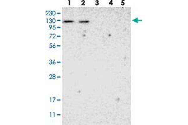ADNP2 anticorps
