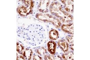 Immunohistochemistry analysis in formalin fixed and paraffin embedded human kidney tissue reacted with PDZK1 Antibody (Center) followed by peroxidase conjugation of the secondary antibody and DAB staining. (PDZK1 antibody  (Middle Region))