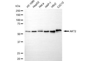 Western blotting analysis using AKT2 antibody (ABIN7800788).