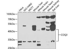 Western blot analysis of extracts of various cell lines, using COQ3 antibody (ABIN6133353, ABIN6138894, ABIN6138895 and ABIN6223356) at 1:1000 dilution. (COQ3 antibody  (AA 50-369))