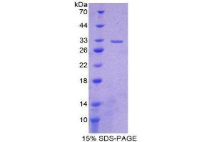 SDS-PAGE (SDS) image for Cytochrome P450, Family 27, Subfamily B, Polypeptide 1 (CYP27B1) (AA 251-500) protein (His tag) (ABIN1878941) (CYP27B1 Protein (AA 251-500) (His tag))