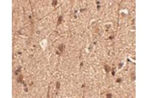 Immunohistochemistry of Slitrk3 in human brain tissue with AP30802PU-N Slitrk3 antibody at 2. (SLITRK3 antibody  (C-Term))