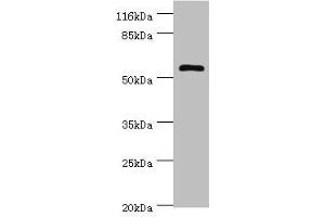 Western blot All lanes: DPH2 antibody at 2 μg/mL + Mouse brain tissue Secondary Goat polyclonal to rabbit IgG at 1/10000 dilution Predicted band size: 53, 28, 39 kDa Observed band size: 53 kDa (DPH2 antibody  (AA 1-489))