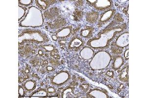 IHC analysis of ERLIN2 using anti-ERLIN2 antibody (ABIN7602582). (ERLIN2 antibody  (AA 87-339))
