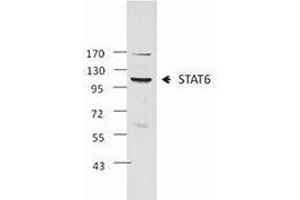 Western Blotting (WB) image for anti-Signal Transducer and Activator of Transcription 6, Interleukin-4 Induced (STAT6) antibody (ABIN2666296)