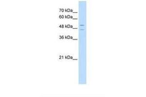 Image no. 1 for anti-STEAP Family Member 3, Metalloreductase (STEAP3) (AA 47-96) antibody (ABIN320799) (STEAP3 antibody  (AA 47-96))