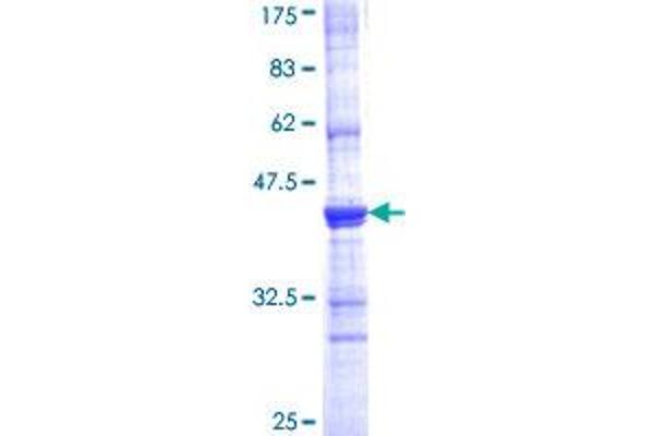 Angiotensin I Converting Enzyme 1 Protein (AA 592-701) (GST tag)