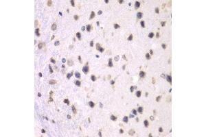 Immunohistochemistry of paraffin-embedded mouse brain using PRMT5 antibody at dilution of 1:100 (x40 lens). (PRMT5 antibody)