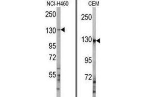 Western Blotting (WB) image for anti-Ubiquitination Factor E4A (UBE4A) antibody (ABIN3001447)