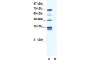 Western Blotting (WB) image for anti-GLIS Family Zinc Finger 2 (GLIS2) antibody (ABIN2460153)