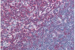 Human Thymus (formalin-fixed, paraffin-embedded) stained with LCP2 antibody ABIN239827 at 10 ug/ml followed by biotinylated anti-mouse IgG secondary antibody ABIN481714, alkaline phosphatase-streptavidin and chromogen. (LCP2 antibody  (AA 216-434))