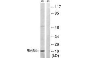 Western blot analysis of extracts from Jurkat cells, using MRPL54 Antibody. (MRPL54 antibody  (AA 81-130))