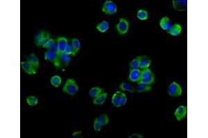 Immunofluorescence staining of MCF-7 cells with ABIN7162123 at 1:133, counter-stained with DAPI. (Occludin antibody  (AA 285-430))