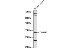 Western blot analysis of extracts of Mouse kidney, using TSP antibody (ABIN7270790) at 1:1000 dilution. (Tetraspanin 6 antibody  (AA 120-200))
